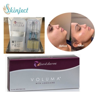 Acide hyaluronique cutané de remplisseur de Juvederm Voluma pour la joue faciale Chin Contour