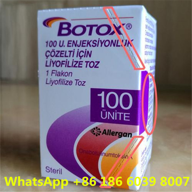 Type botulinum d'Allergan  une toxine pour les produits anti-vieillissement de peau