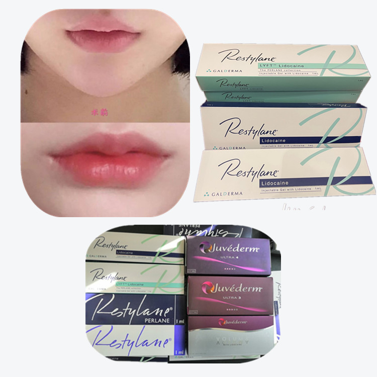 Acide hyaluronique lié croisé Produits de remplissage cutané anti-âge