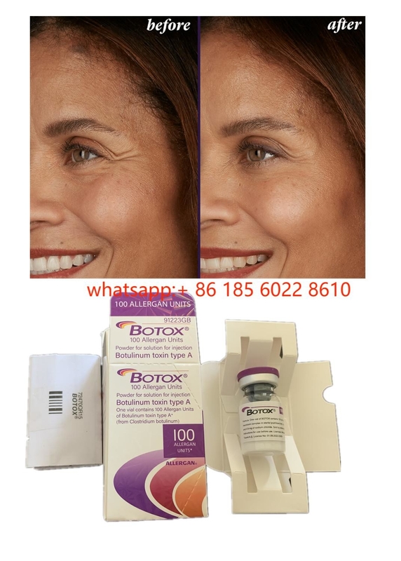 Produits de beauté Allergan 100 unités Toxine botulique  pour les rides du visage Remplisseur cutané