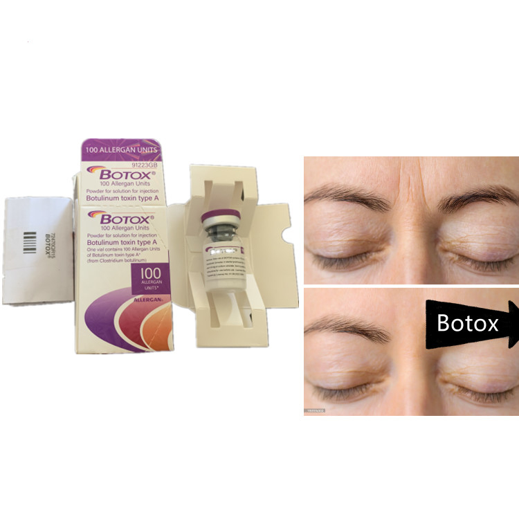 Allergan 100ui sérum de toxine botulique produit anti-âge pour le dysport du visage