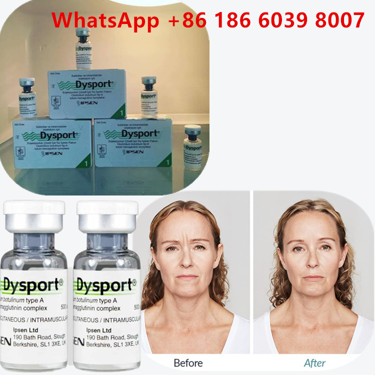Toxine botulique de type A 100 unités Injection de  pour les rides du visage