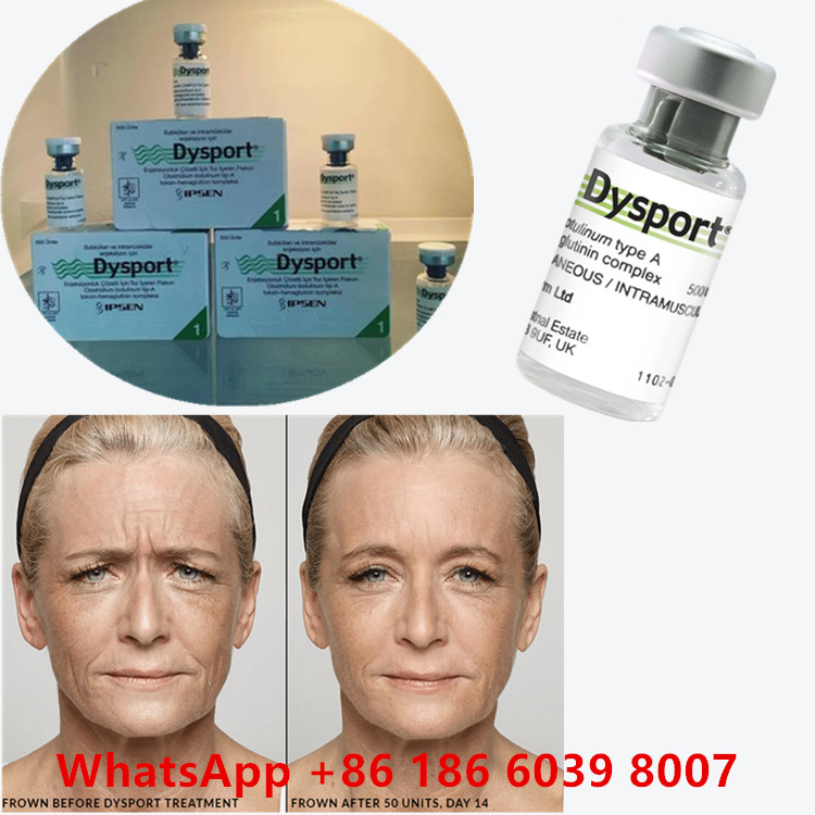 Toxine botulique 100 unités BTX Injection de type A Utilisation cosmétique