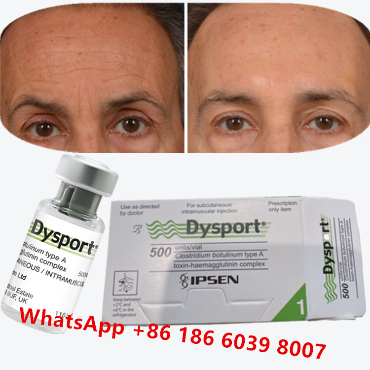 Dysport de la toxine botulique Clostridium botulinum type A pour les pattes de corbeau