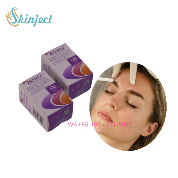 Allergan Botox 100 UI Injectable pour réduire les rides Les lignes du front Traitement de la toxine botulique pour les rides