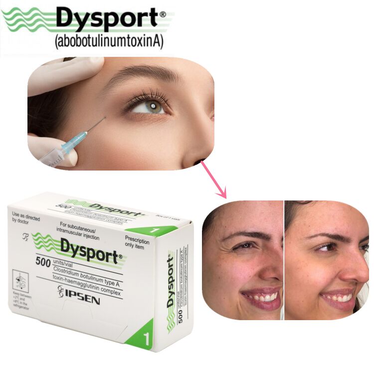 500u Dysport Disparition des Rides du Visage Poudre Lyophilisée Traitement Personnalisé OEM Dysport