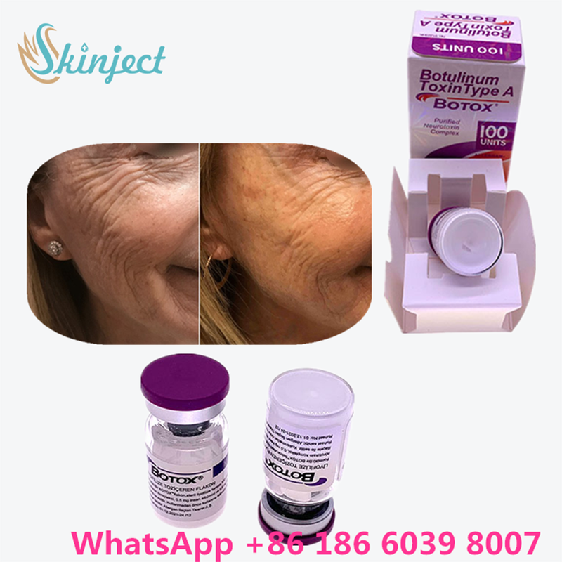 Toxine botulique allergène Botox poudre blanche Traitement efficace des rides du visage et de la relaxation musculaire en médecine