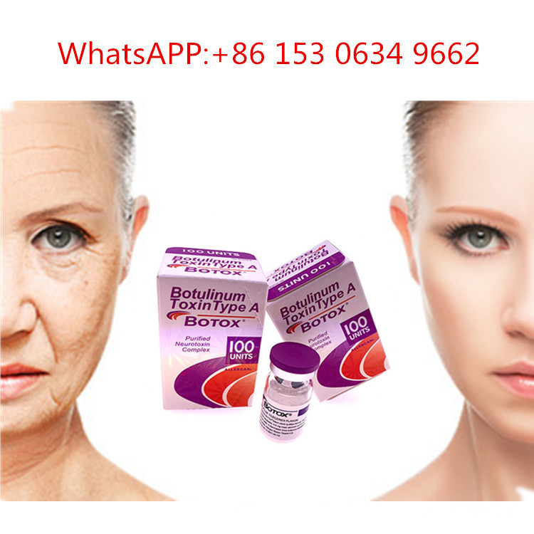 type de 50u 100u 150u une toxine botulinum d'injection d'Allergan  pour l'anti ride