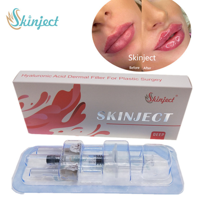Remplisseurs cutanés des lèvres 2ml d'acide hyaluronique profond de Skinject injectables
