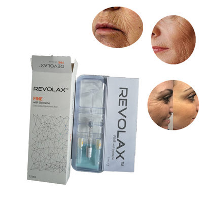 Injections faciales Juviderm Revolax d'acide hyaluronique durable