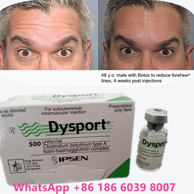 Toxine botulique poudre de  Dysport 100 IU/1 vials pour le vieillissement de la peau