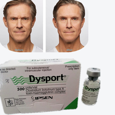Toxine botulique dysport 100 UI Toxine botulique de type A pour l' élimination des rides