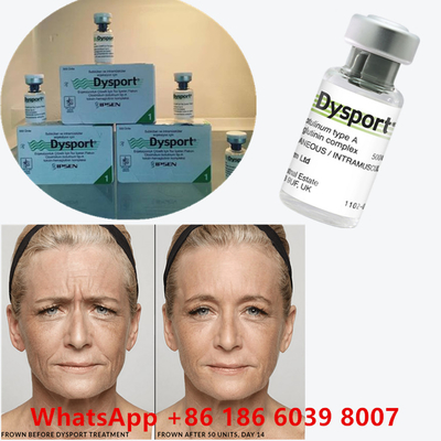 Toxine botulique 100 unités BTX Injection de type A Utilisation cosmétique