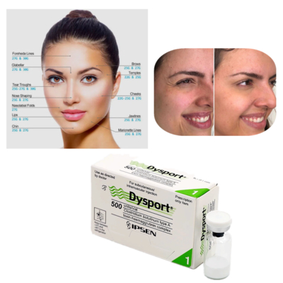 Dysport 500U Toxine Botulique de Type A pour le Traitement des Rides