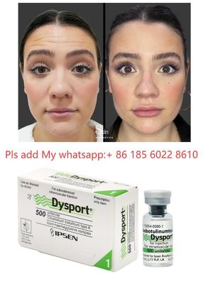 Injection Dysport 500iu Anti-rides Toxine Botulique Allergan Botulax