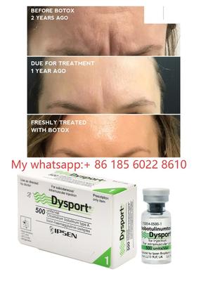 Injections de Dysport 500UI Toxine Botulique Allergan Botulax - Lissage des rides et ridules