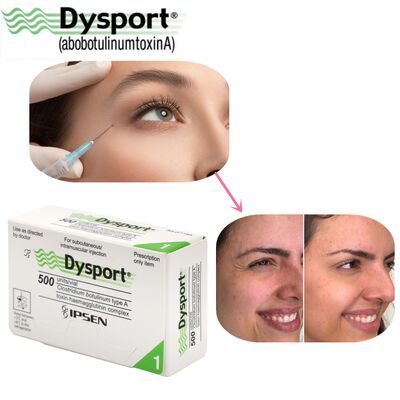 500u Dysport Disparition des Rides du Visage Poudre Lyophilisée Traitement Personnalisé OEM Dysport